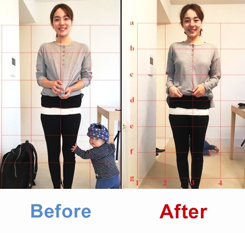川崎市のお客様の骨盤ビフォーアフター写真 腰痛の改善例 産後骨盤矯正 東京23区へ出張訪問 バランス工房