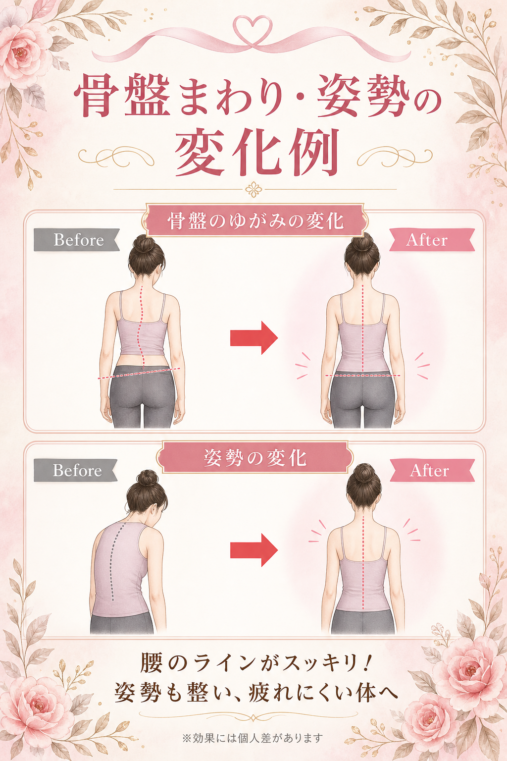 骨盤まわり 姿勢の変化例 イラスト解説