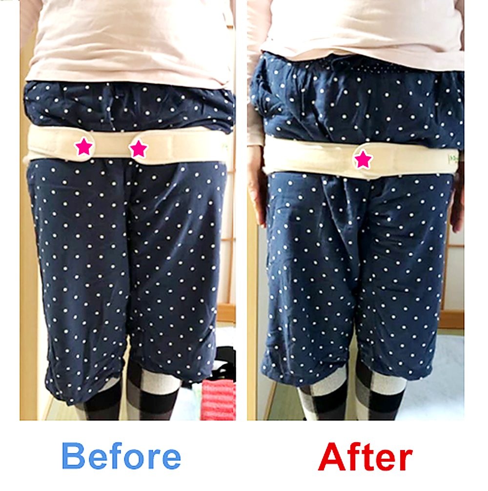 バランス工房 産後骨盤矯正 Before/After 比較 #001/55|骨盤の開き・体型変化