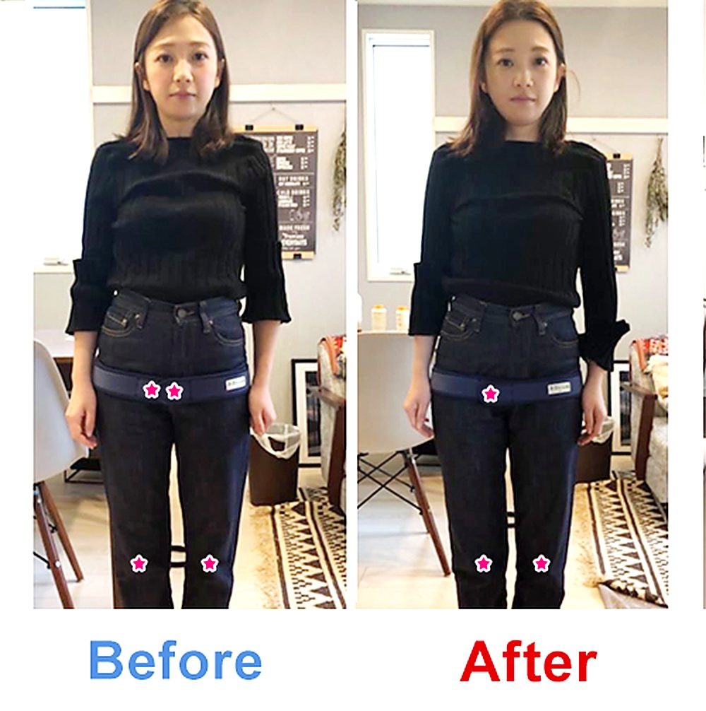 バランス工房 産後骨盤矯正 Before/After 比較 #002/55|骨盤の開き・体型変化