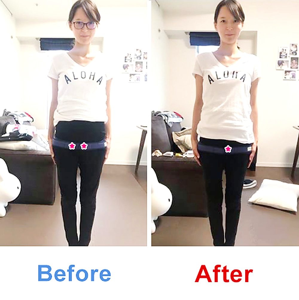 バランス工房 産後骨盤矯正 Before/After 比較 #003/55|骨盤の開き・体型変化