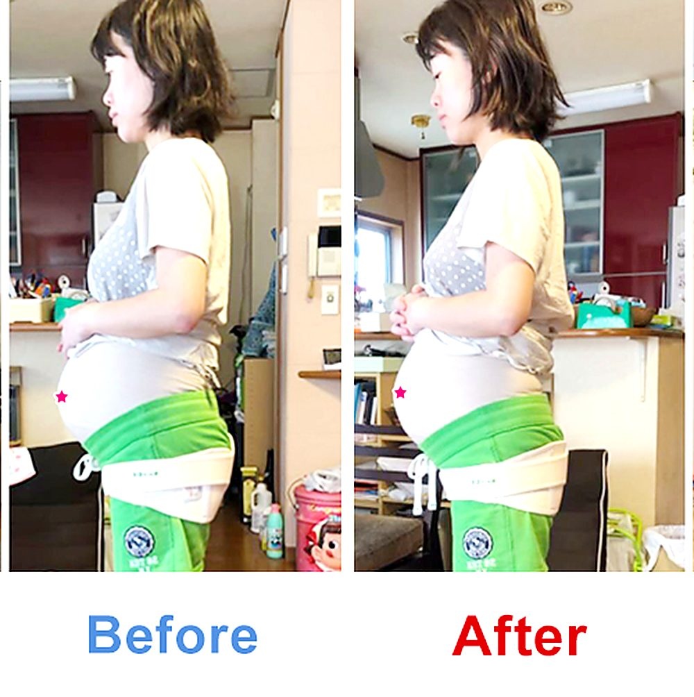 バランス工房 産後骨盤矯正 Before/After 比較 #004/55|骨盤の開き・体型変化
