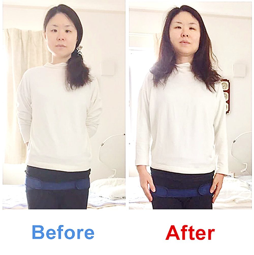 バランス工房 産後骨盤矯正 Before/After 比較 #008/55|骨盤の開き・体型変化
