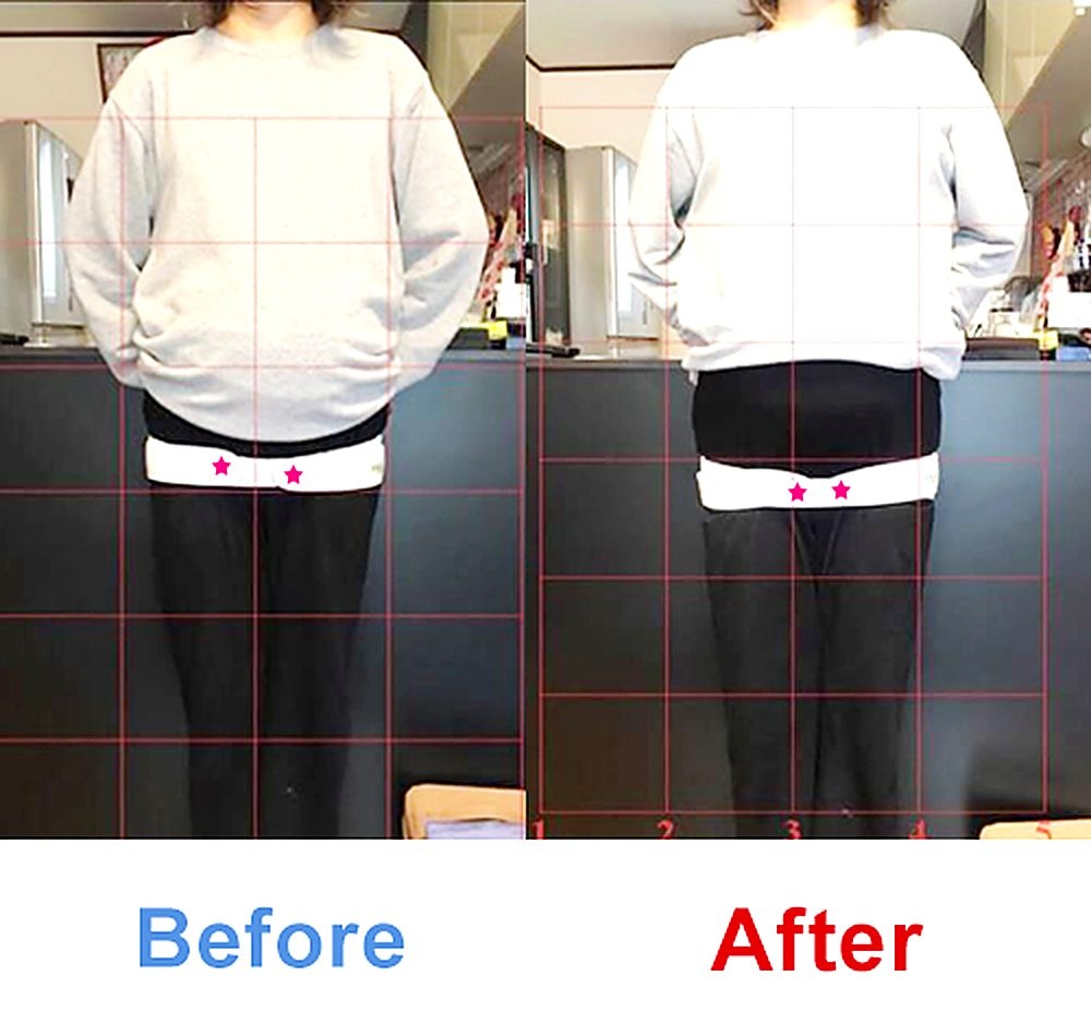 バランス工房 産後骨盤矯正 Before/After 比較 #009/55|骨盤の開き・体型変化