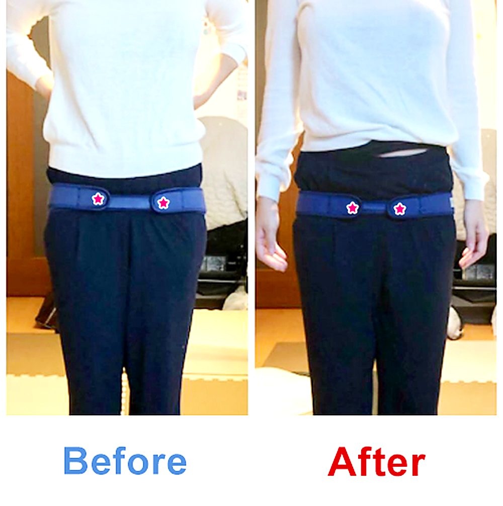 バランス工房 産後骨盤矯正 Before/After 比較 #010/55|骨盤の開き・体型変化