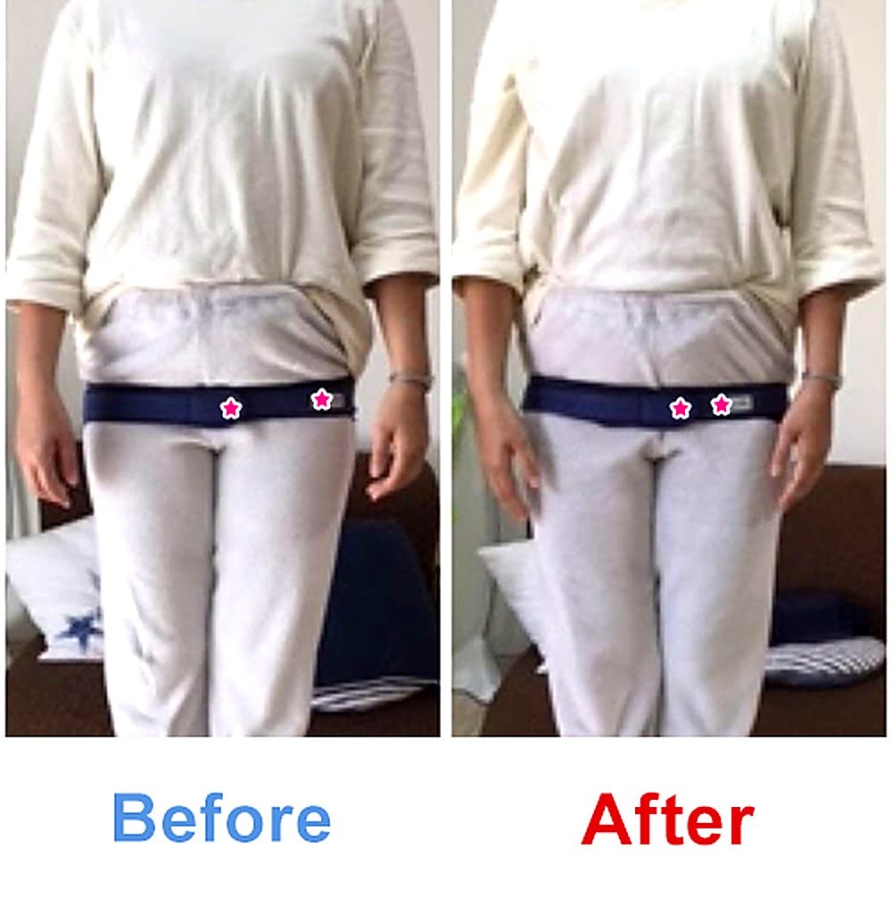 バランス工房 産後骨盤矯正 Before/After 比較 #015/55|骨盤の開き・体型変化