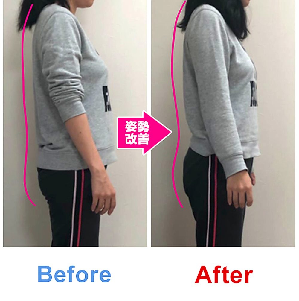 バランス工房 産後骨盤矯正 Before/After 比較 #016/55|骨盤の開き・体型変化