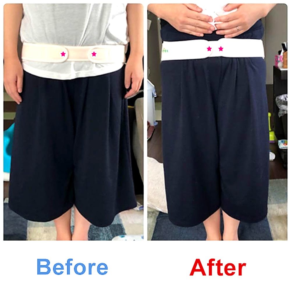 バランス工房 産後骨盤矯正 Before/After 比較 #018/55|骨盤の開き・体型変化