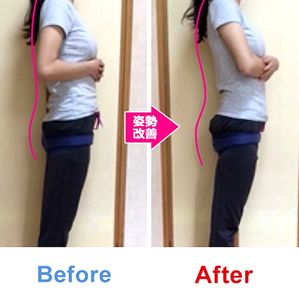 バランス工房 産後骨盤矯正 Before/After 比較 #020/55|骨盤の開き・体型変化