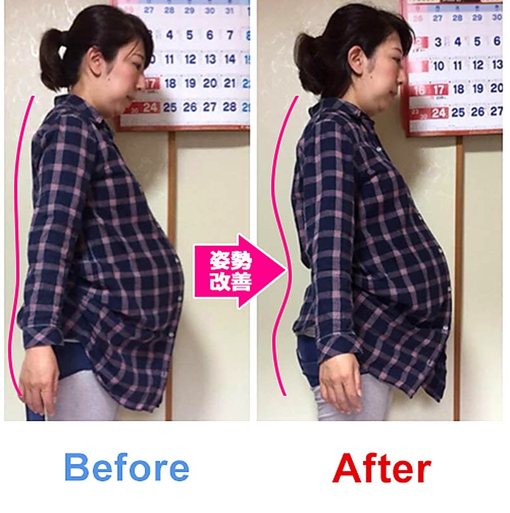 バランス工房 産後骨盤矯正 Before/After 比較 #021/55|骨盤の開き・体型変化
