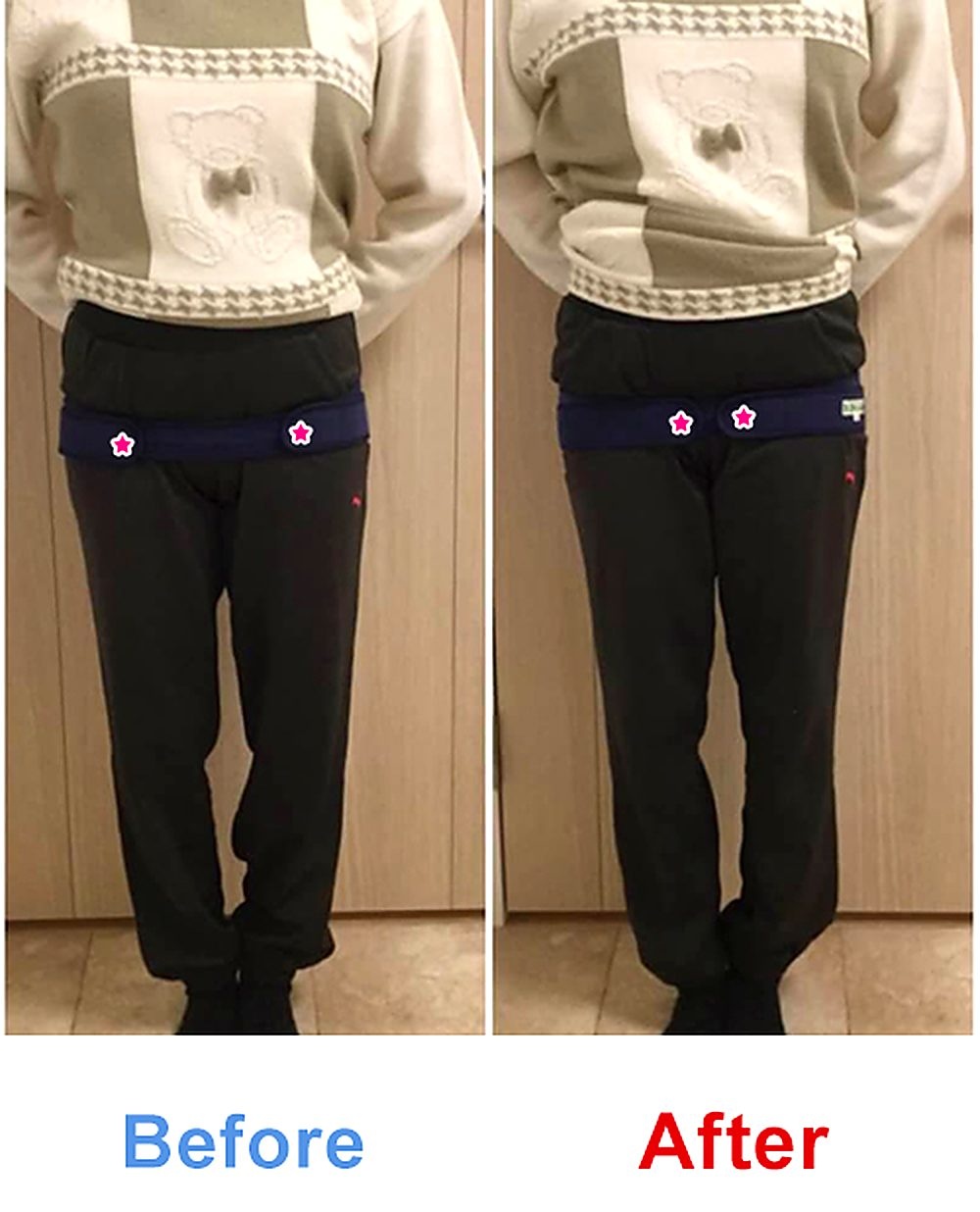 バランス工房 産後骨盤矯正 Before/After 比較 #025/55|骨盤の開き・体型変化