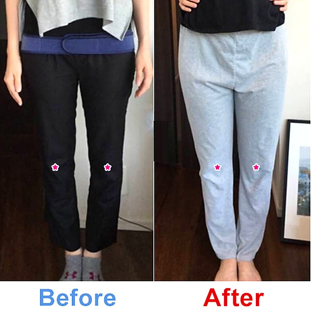 バランス工房 産後骨盤矯正 Before/After 比較 #029/55|骨盤の開き・体型変化
