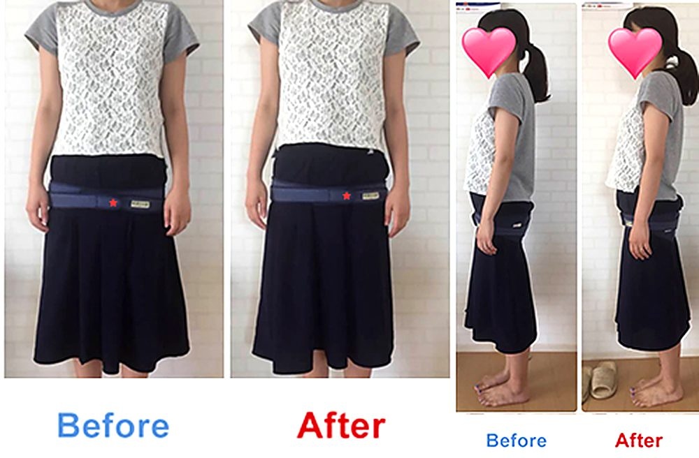 バランス工房 産後骨盤矯正 Before/After 比較 #031/55|骨盤の開き・体型変化