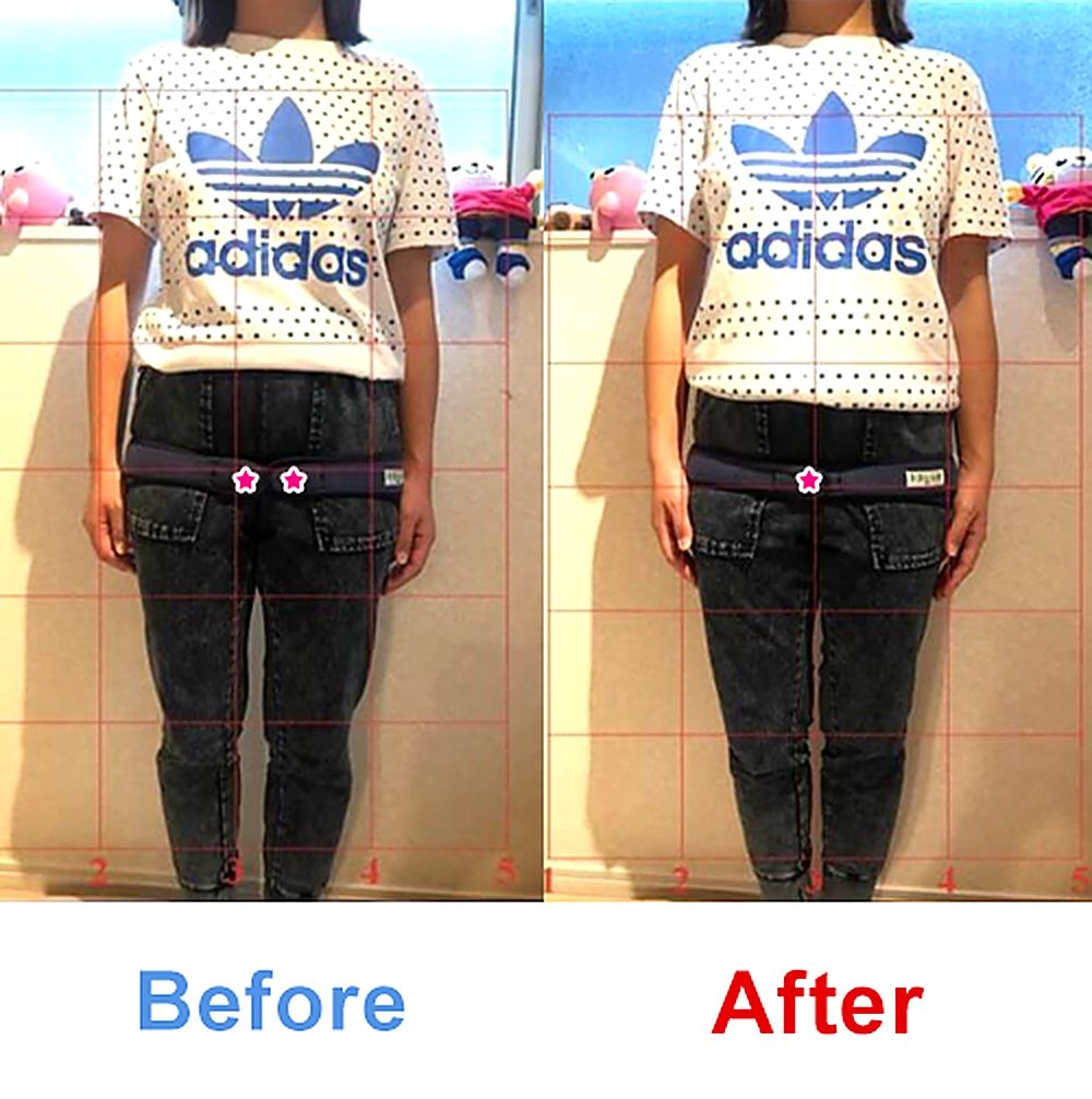 バランス工房 産後骨盤矯正 Before/After 比較 #032/55|骨盤の開き・体型変化