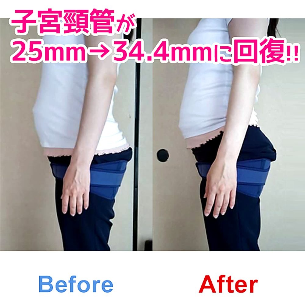 バランス工房 産後骨盤矯正 Before/After 比較 #034/55|骨盤の開き・体型変化