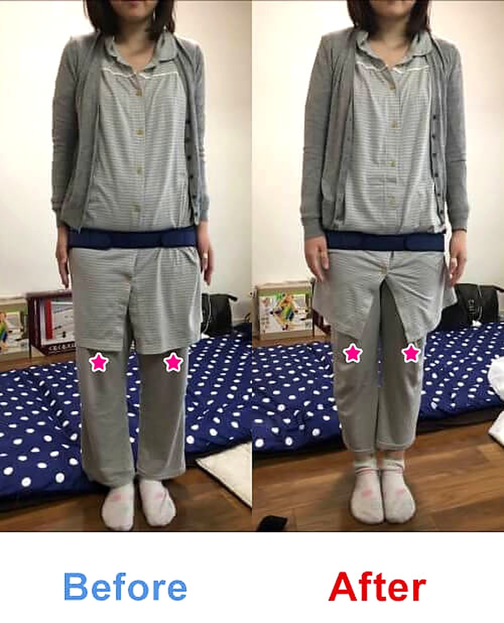 バランス工房 産後骨盤矯正 Before/After 比較 #040/55|骨盤の開き・体型変化