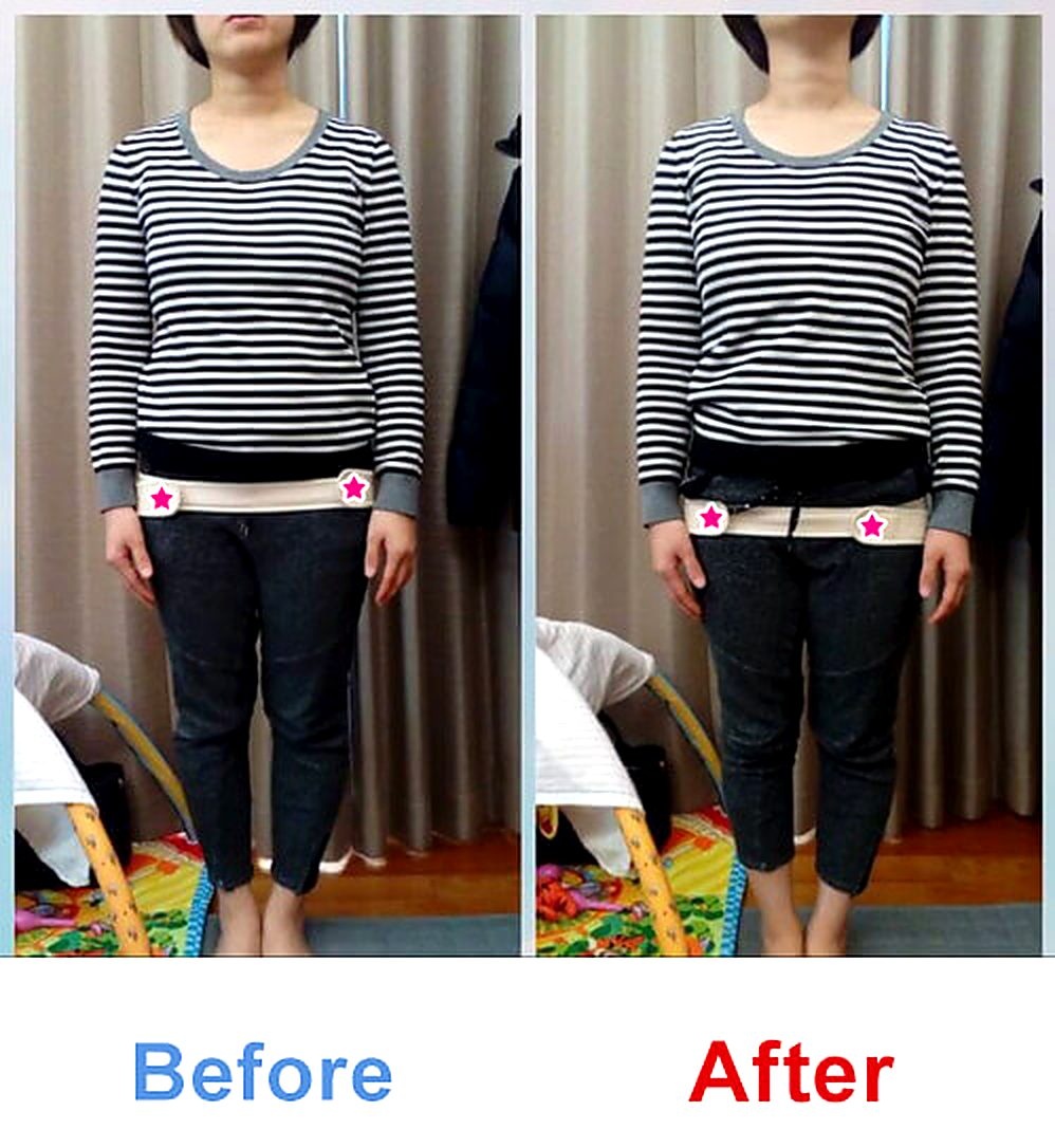 バランス工房 産後骨盤矯正 Before/After 比較 #041/55|骨盤の開き・体型変化