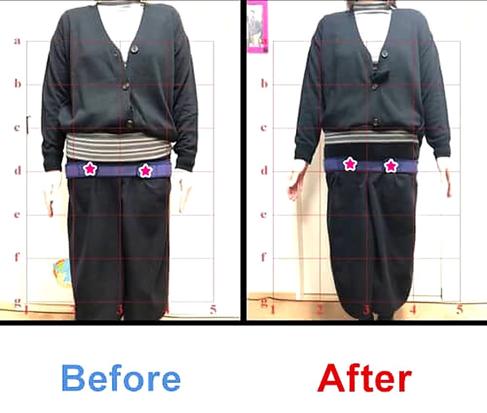 バランス工房 産後骨盤矯正 Before/After 比較 #043/55|骨盤の開き・体型変化
