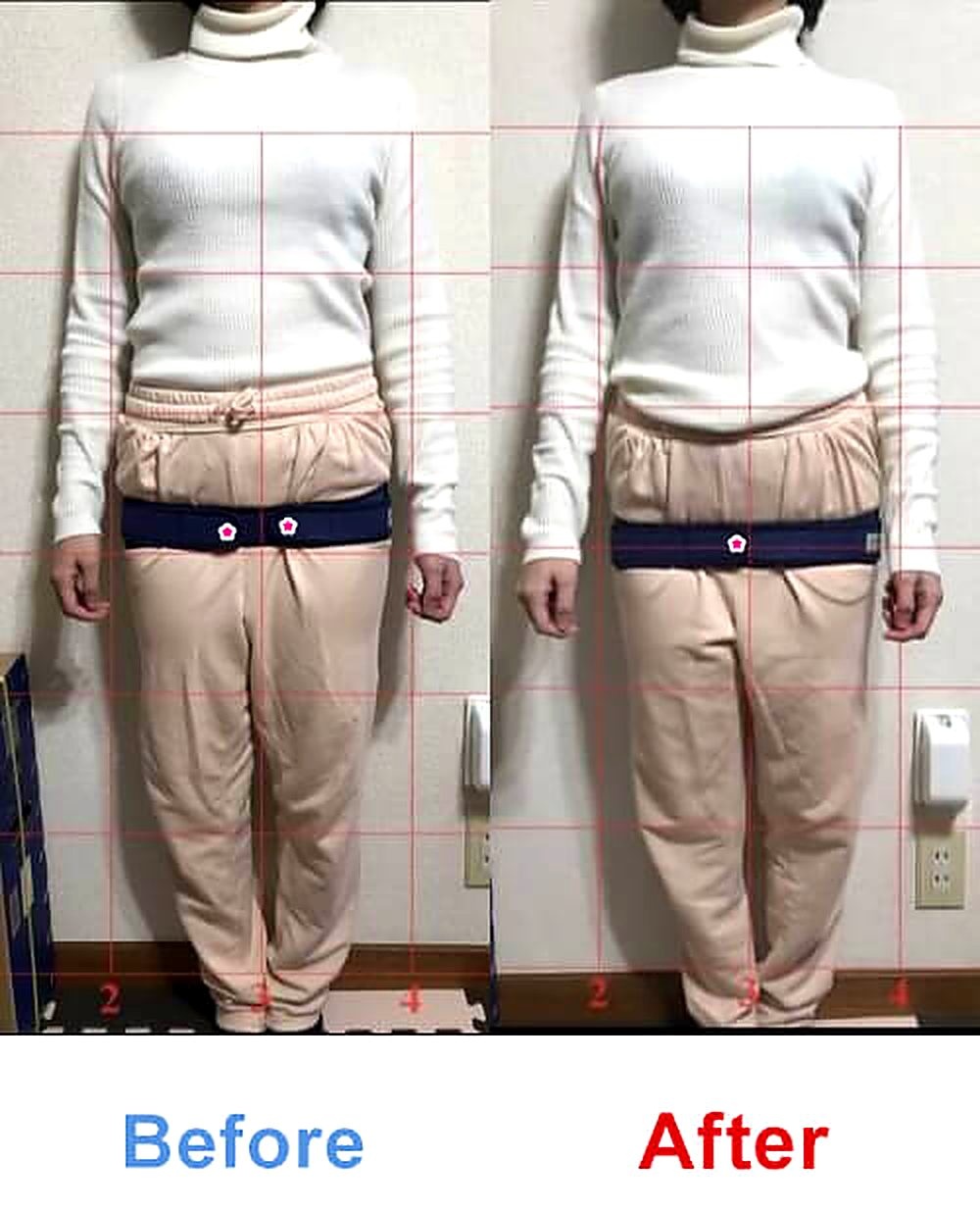 バランス工房 産後骨盤矯正 Before/After 比較 #045/55|骨盤の開き・体型変化
