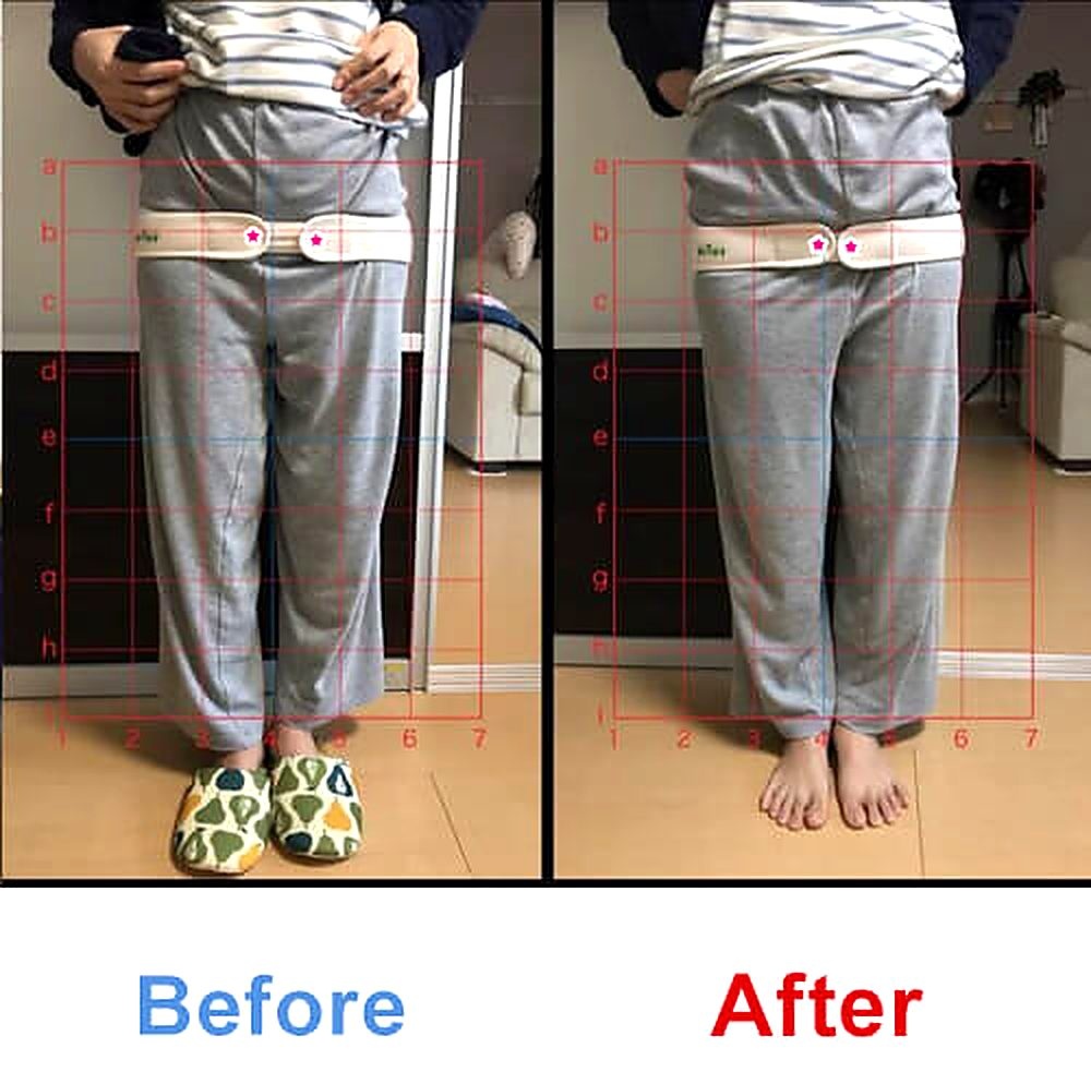 バランス工房 産後骨盤矯正 Before/After 比較 #046/55|骨盤の開き・体型変化