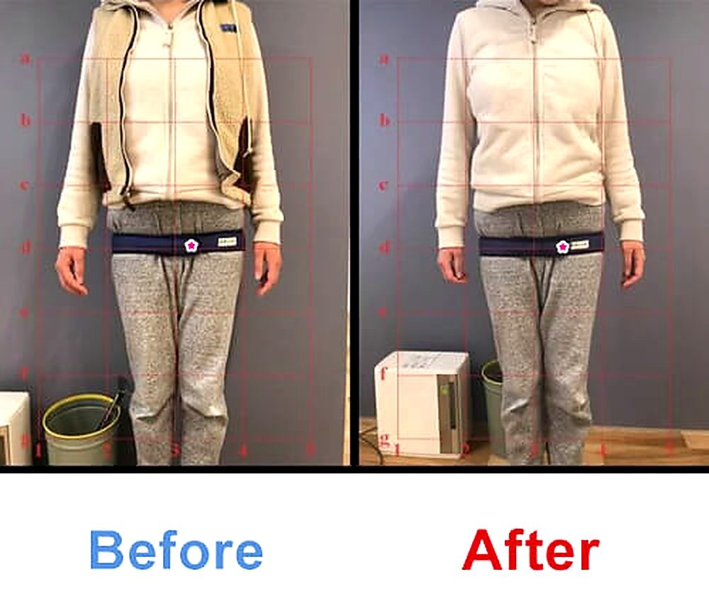 バランス工房 産後骨盤矯正 Before/After 比較 #050/55|骨盤の開き・体型変化