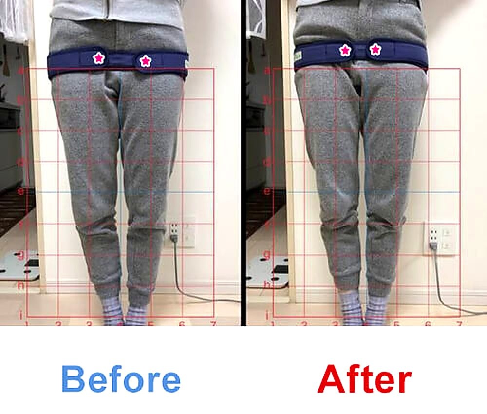 バランス工房 産後骨盤矯正 Before/After 比較 #051/55|骨盤の開き・体型変化