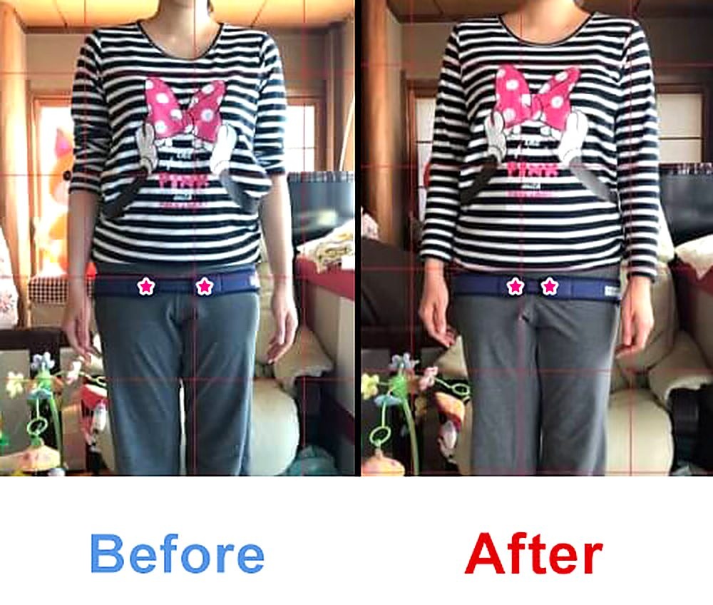 バランス工房 産後骨盤矯正 Before/After 比較 #054/55|骨盤の開き・体型変化