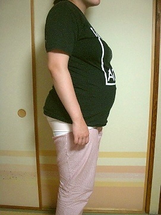 千葉県 船橋市 Aさま (30代 女性) お写真