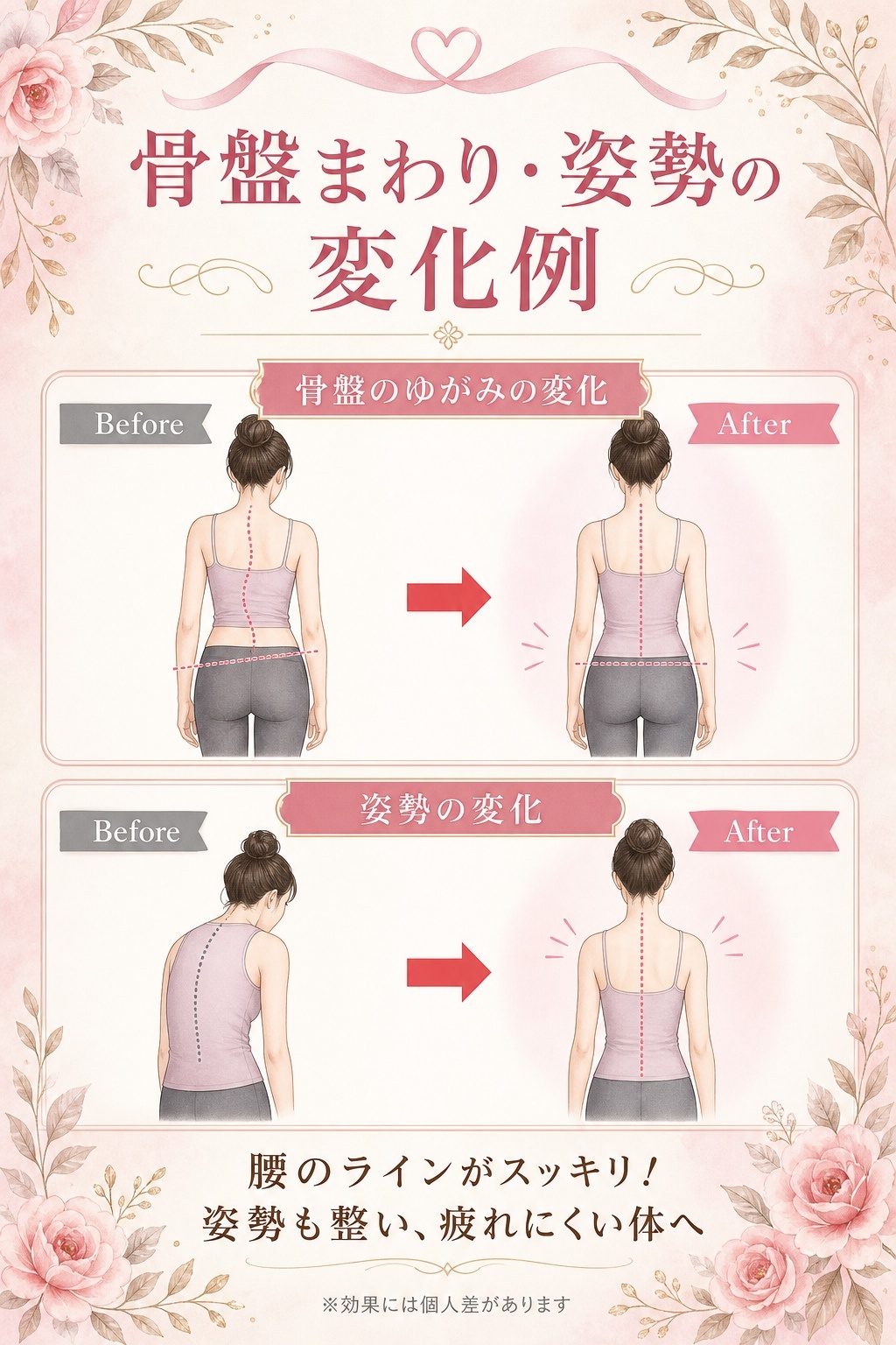 骨盤まわり 姿勢の変化例 イラスト解説