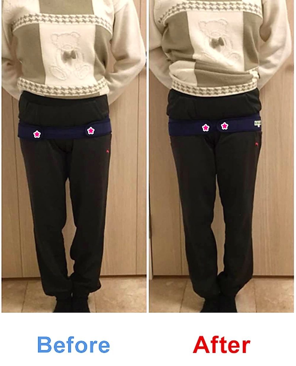 産後骨盤矯正 実例 Before/After #3